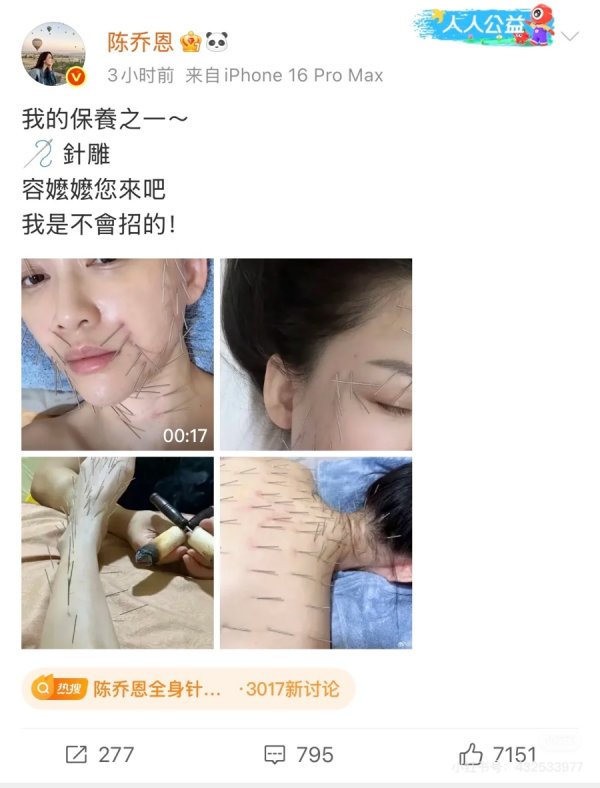 恒盈配资 女星同款“针雕”美容走红社媒，针灸美容是伪科学还是“真管用”？